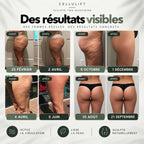 Cellulift — Legging 3D